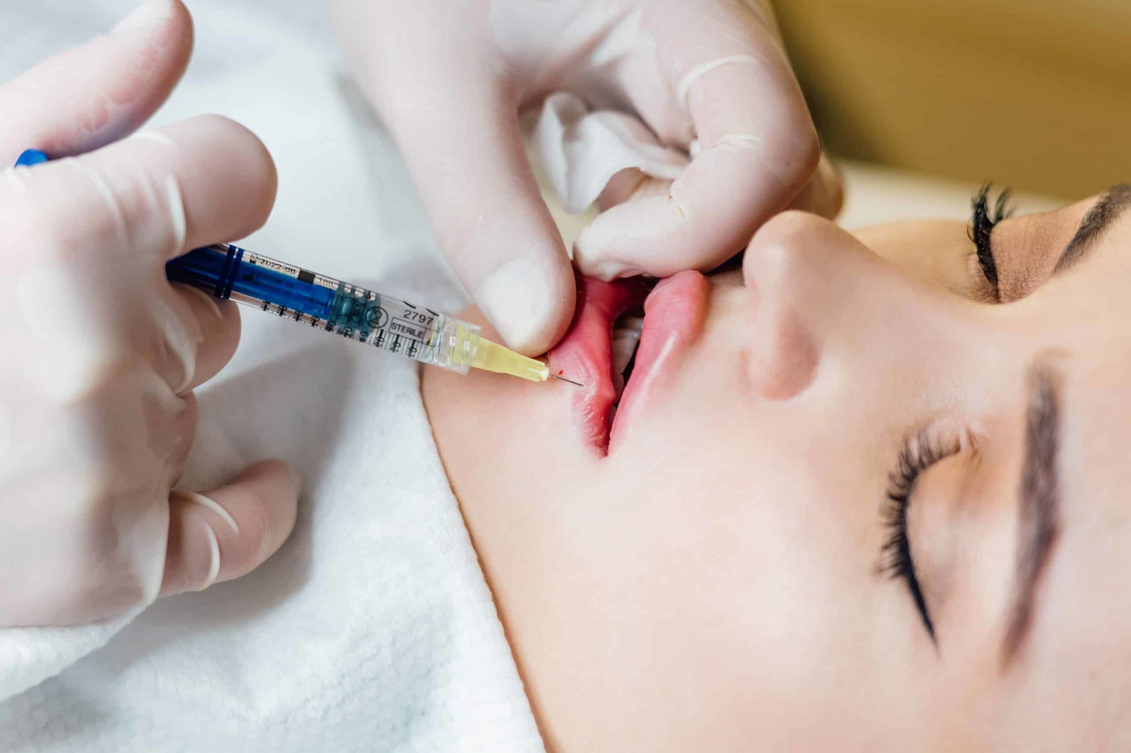 How Much Does a Lip Flip Cost - Injectco