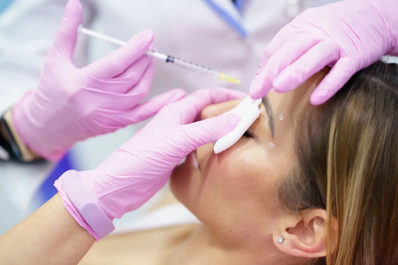 botox myths
