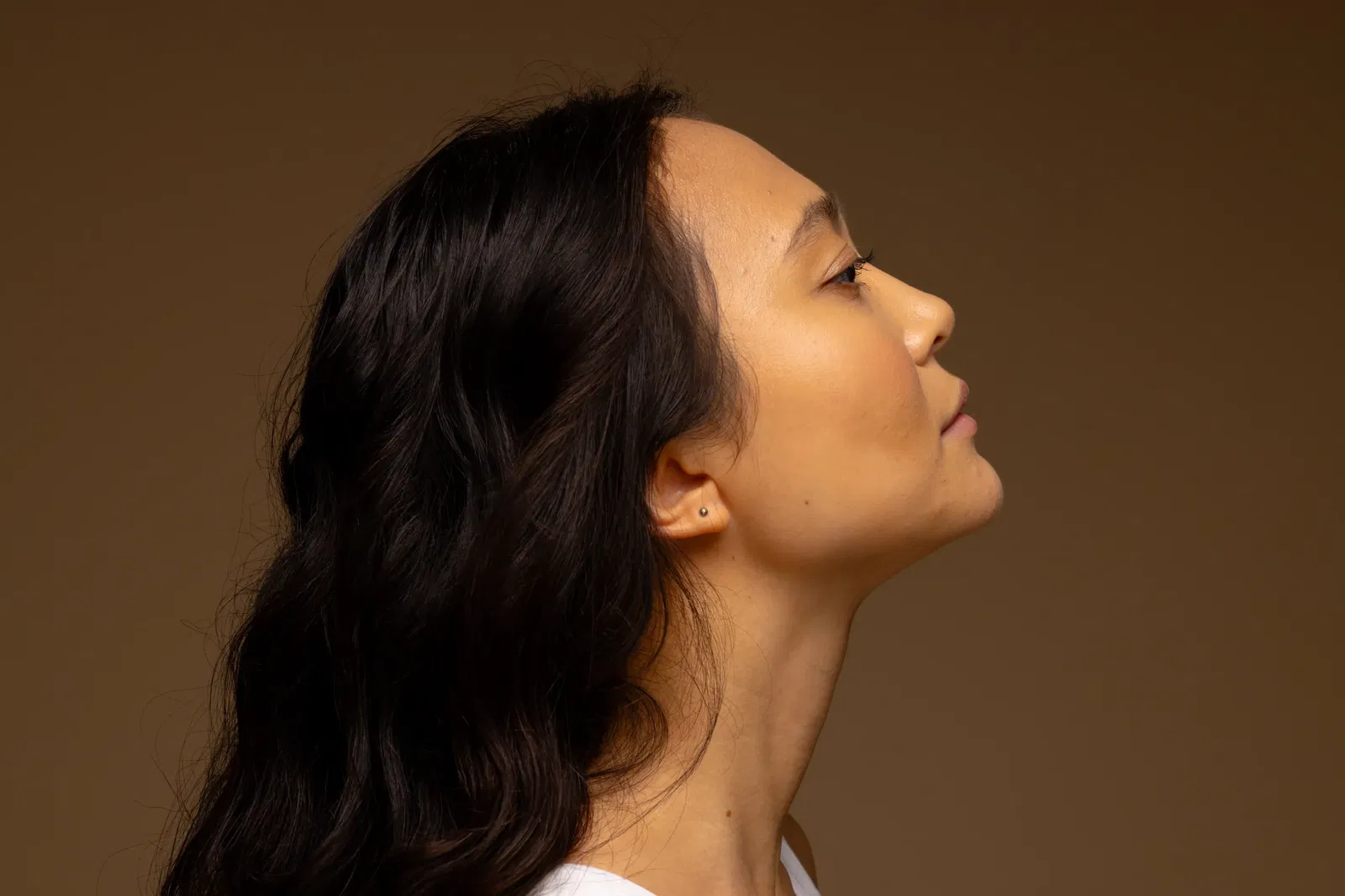 kybella side effects