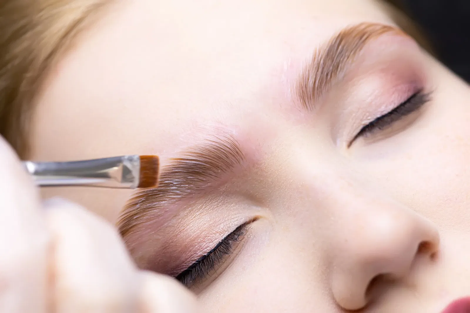 botox brow lift